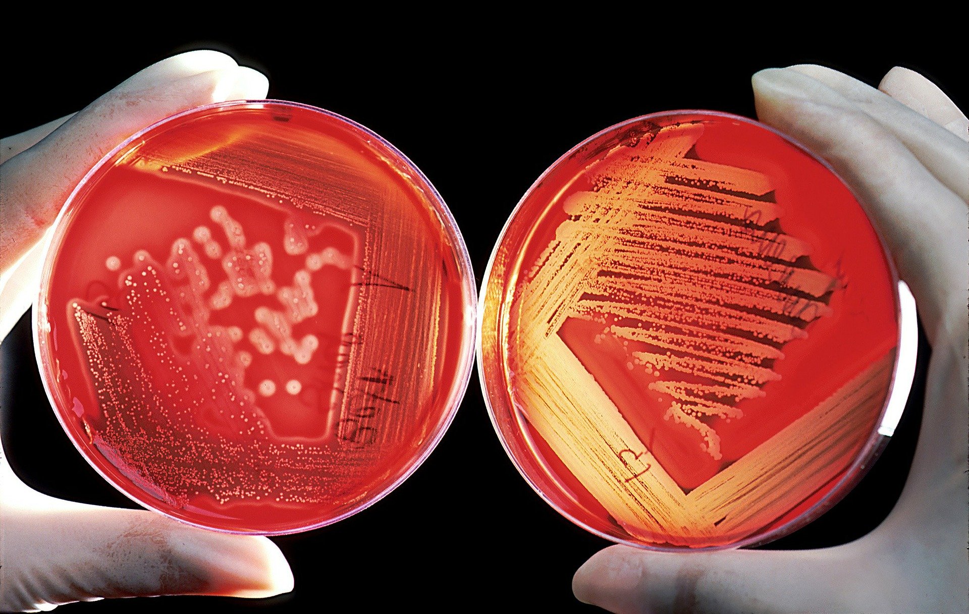 Efficacia degli interventi di prevenzione delle infezioni alle vie urinarie correlate al catetere vescicale