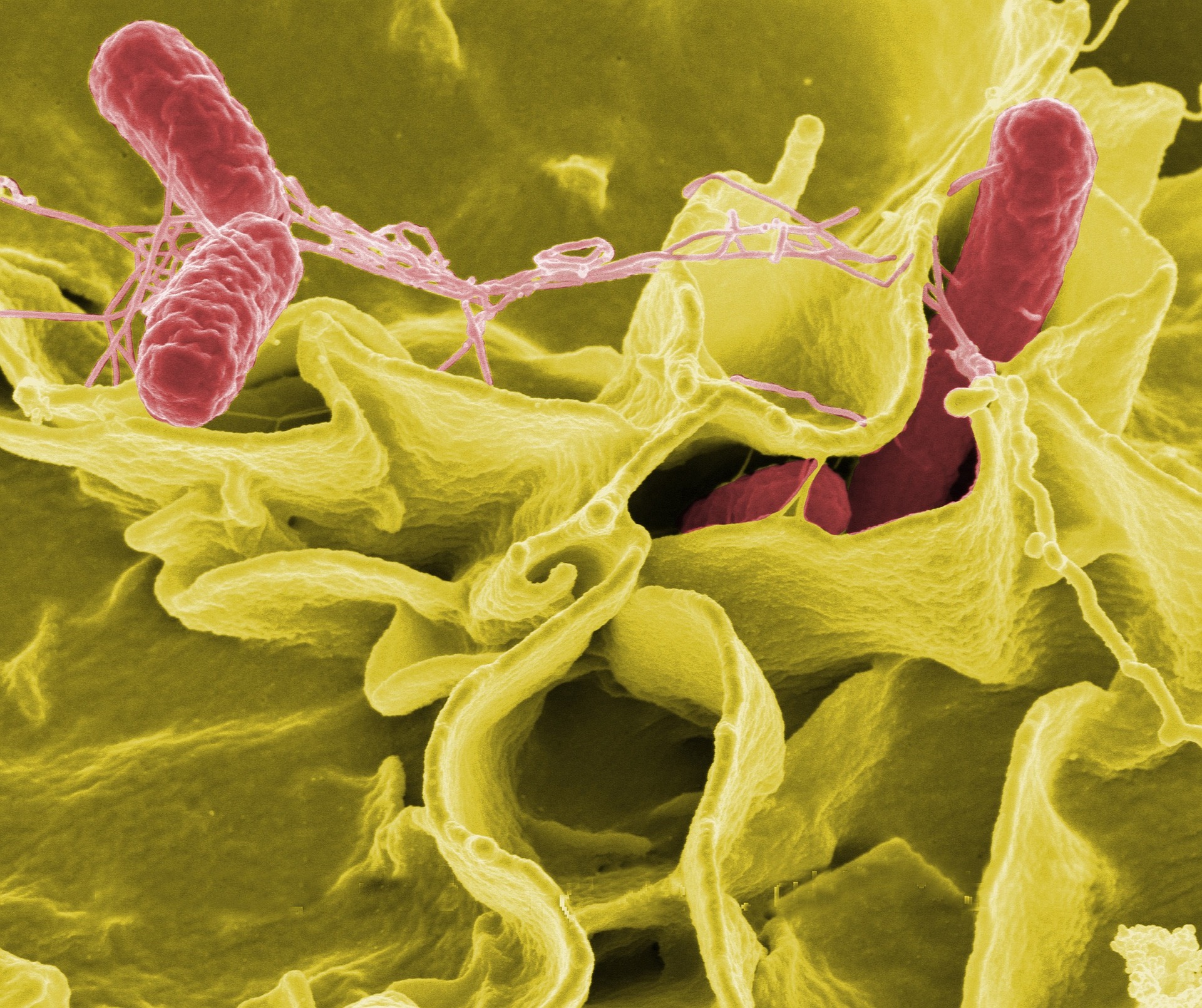 Prevenire e contenere le infezioni da patogeni multiresistenti in ambiente intensivo: l’esperienza della Rianimazione dell’Ospedale di Dolo, Ulss 3 Serenissima